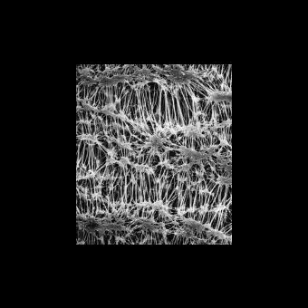 Фильтр, Флуоропор, d пор 0,22 мкм, d мембраны 47 мм, 100 шт., Merck Millipore, FGLP04700