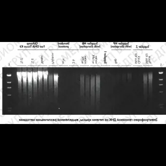 Набор для выделения ДНК из тканей QIAamp Fast DNA Tissue Kit, Qiagen, 51404, 50 выделений