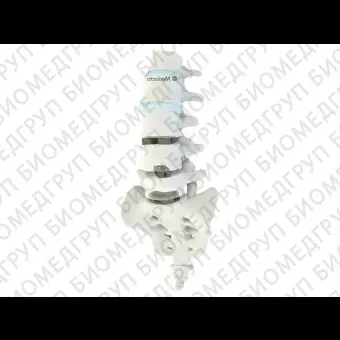 Межтеловой кейдж для грудопоясничнокрестцовой зоны MectaLIF PLIF