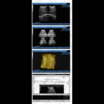 Ультразвуковой сканер на платформе Sonoview