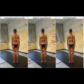 Система оценки осанки 3D B.A.K. Body Analysis Kapture