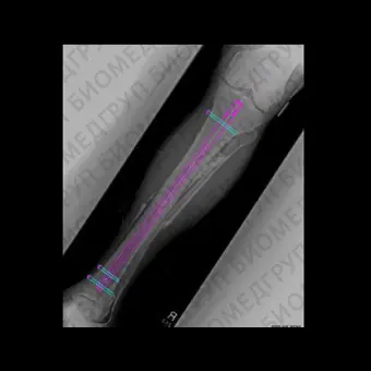 Медицинское программное обеспечение OrthoView