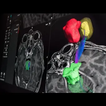 Клиническое программное обеспечение Brainlab Elements