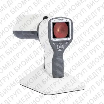 Немидриатическая ретинальная камера Smartscope PRO