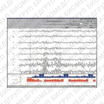 Программное обеспечение для EMG SleepSign