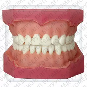 Модель верхней и нижней челюстей с 32 интактными зубами для анестезии