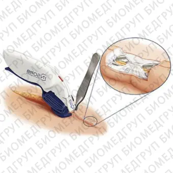 Хирургический степлер для закрытия кожных ран INSORB 30