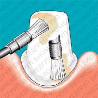 Sonicflex clean brush 1  насадкащетка плоская малая для чистки зубов