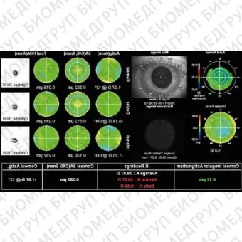 Роговичный топограф KR1W