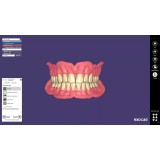 Exocad Full Denture Module - модуль для создания полносъемных протезов